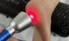 High-Intensity Laser Therapy: Find Local Experts Today