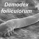 Demodex Mites’ Role in Chronic Dry Eye Issues