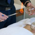 Cupping Therapy Benefits: Explore Healing in Melbourne